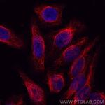 Vimentin Antibody in Immunocytochemistry (ICC/IF)