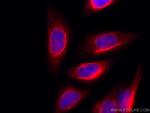 Vimentin Antibody in Immunocytochemistry (ICC/IF)