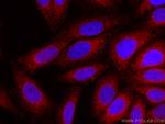 Calnexin Antibody in Immunocytochemistry (ICC/IF)