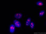 DDX21 Antibody in Immunocytochemistry (ICC/IF)