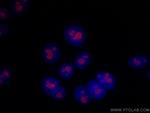 RBM15 Antibody in Immunocytochemistry (ICC/IF)