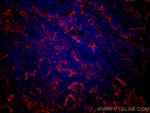 ICAM-1 Antibody in Immunohistochemistry (Paraffin) (IHC (P))