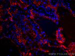 ICAM-1 Antibody in Immunohistochemistry (Paraffin) (IHC (P))