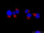 Syntaxin 6 Antibody in Immunocytochemistry (ICC/IF)