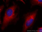 CYB5R3 Antibody in Immunocytochemistry (ICC/IF)