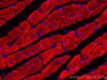 Myosin Light Chain 2/MLC-2V Antibody in Immunohistochemistry (Paraffin) (IHC (P))