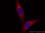 PLOD3 Antibody in Immunocytochemistry (ICC/IF)