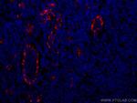 CD31 Antibody in Immunohistochemistry (Paraffin) (IHC (P))