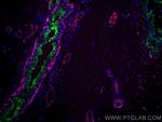 CD31 Antibody in Immunohistochemistry (Paraffin) (IHC (P))