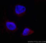 CENPJ Antibody in Immunocytochemistry (ICC/IF)