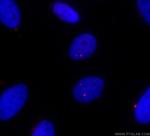 IFT81 Antibody in Immunocytochemistry (ICC/IF)