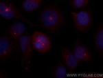 CSPP1 Antibody in Immunocytochemistry (ICC/IF)