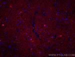 Mu Crystallin Antibody in Immunohistochemistry (Paraffin) (IHC (P))