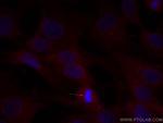 SDCCAG8 Antibody in Immunocytochemistry (ICC/IF)