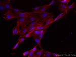 Calponin Antibody in Immunocytochemistry (ICC/IF)