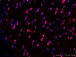 OLIG2 Antibody in Immunohistochemistry (Paraffin) (IHC (P))