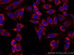 TOM70 Antibody in Immunocytochemistry (ICC/IF)