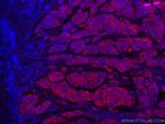 S100 Beta Antibody in Immunohistochemistry (Paraffin) (IHC (P))