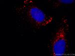 ADRP/Perilipin 2 Antibody in Immunocytochemistry (ICC/IF)