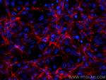 Fibronectin Antibody in Immunocytochemistry (ICC/IF)