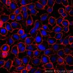CD44 Antibody in Immunocytochemistry (ICC/IF)
