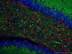 GFAP Antibody in Immunohistochemistry (Paraffin) (IHC (P))
