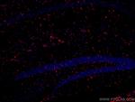 GFAP Antibody in Immunohistochemistry (Paraffin) (IHC (P))