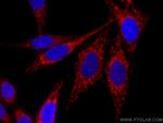 MFF Antibody in Immunocytochemistry (ICC/IF)