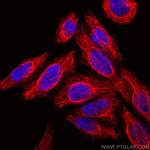 Cytokeratin 7 Antibody in Immunocytochemistry (ICC/IF)