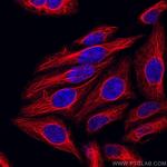 Cytokeratin 7 Antibody in Immunocytochemistry (ICC/IF)