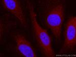 VEGFA Antibody in Immunocytochemistry (ICC/IF)