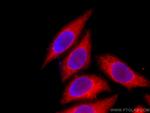 TMEM173/STING Antibody in Immunocytochemistry (ICC/IF)