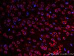 S1PR2 Antibody in Immunohistochemistry (Paraffin) (IHC (P))