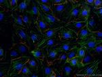 ZO-1 Antibody in Immunocytochemistry (ICC/IF)