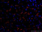 N-cadherin Antibody in Immunohistochemistry (Paraffin) (IHC (P))