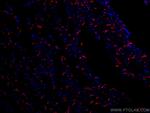 N-cadherin Antibody in Immunohistochemistry (Paraffin) (IHC (P))