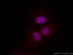Glucocorticoid receptor Antibody in Immunocytochemistry (ICC/IF)