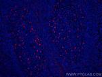 CD68 Antibody in Immunohistochemistry (Paraffin) (IHC (P))