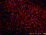 TH Antibody in Immunohistochemistry (Paraffin) (IHC (P))