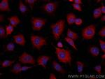 Vinculin Antibody in Immunocytochemistry (ICC/IF)