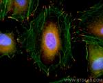 Vinculin Antibody in Immunocytochemistry (ICC/IF)