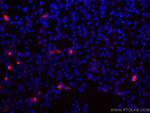 GFP tag Antibody in Immunocytochemistry (ICC/IF)