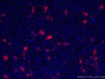 HA tag Antibody in Immunocytochemistry (ICC/IF)