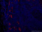ACKR2 Antibody in Immunohistochemistry (Paraffin) (IHC (P))