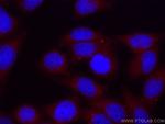 Septin 2 Antibody in Immunocytochemistry (ICC/IF)