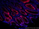 Gastrokine 1 Antibody in Immunohistochemistry (Paraffin) (IHC (P))