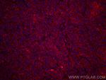 TNFR1 Antibody in Immunohistochemistry (Paraffin) (IHC (P))