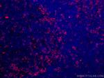 ZAP70 Antibody in Immunohistochemistry (Paraffin) (IHC (P))