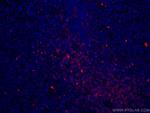 CD7 Antibody in Immunohistochemistry (Paraffin) (IHC (P))