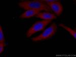 SND1 Antibody in Immunocytochemistry (ICC/IF)